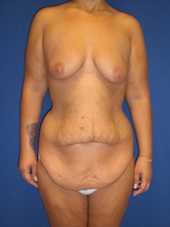 After Image
