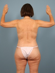 After Image