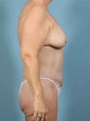After Image
