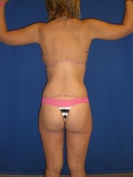 After Image