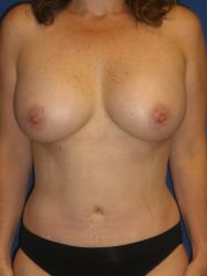 After Image