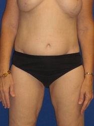 After Image