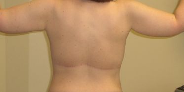 After Image