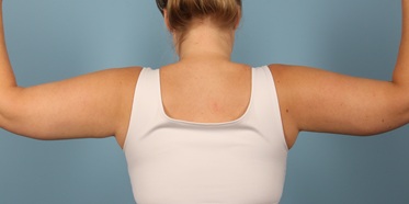 After Image