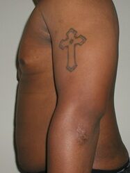 Before Image