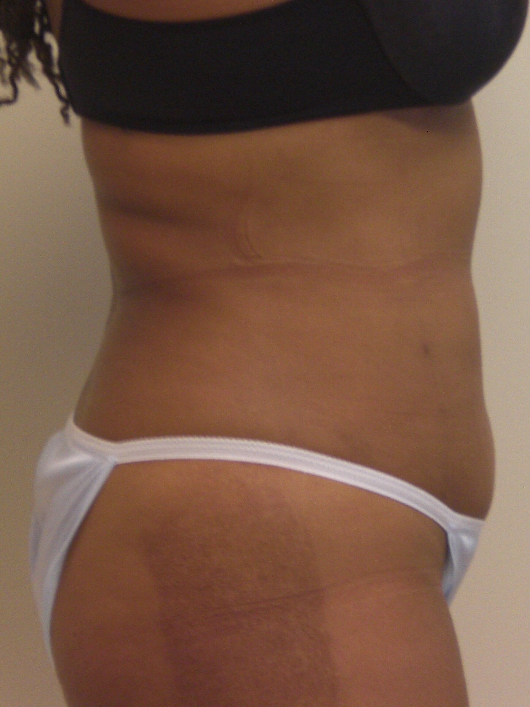 After Image