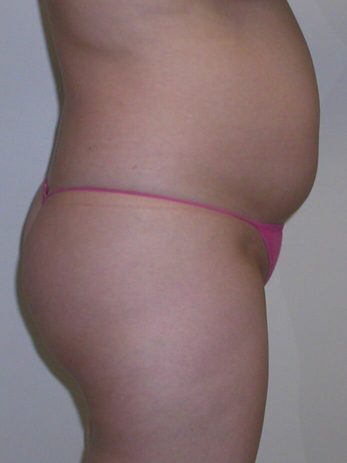 Before Image