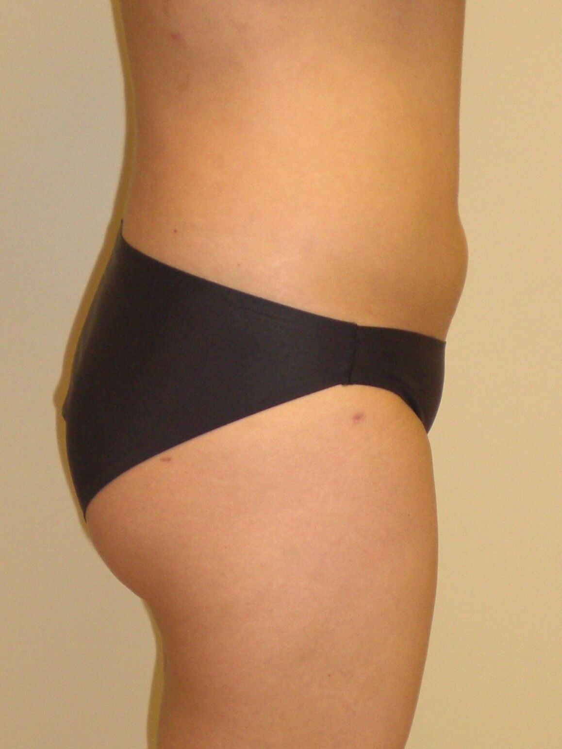 After Image