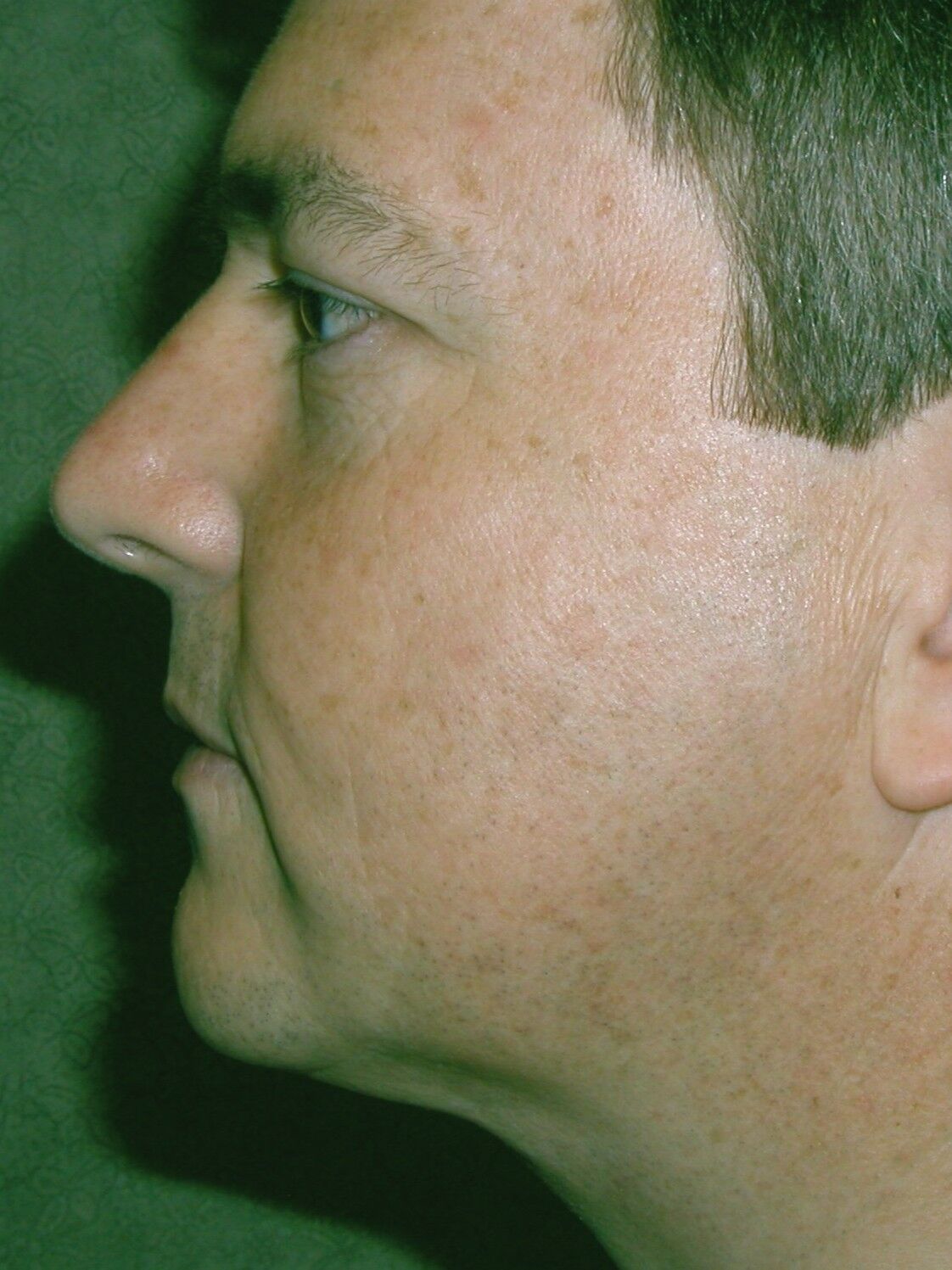 After Image