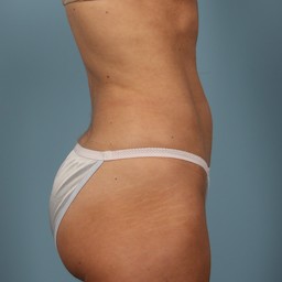 After Image