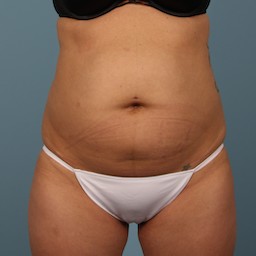 Before Image