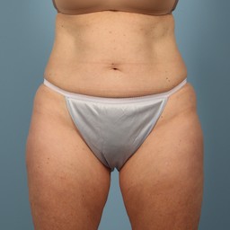 After Image