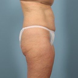 After Image