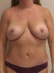 After Image