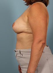 After Image