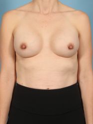After Image