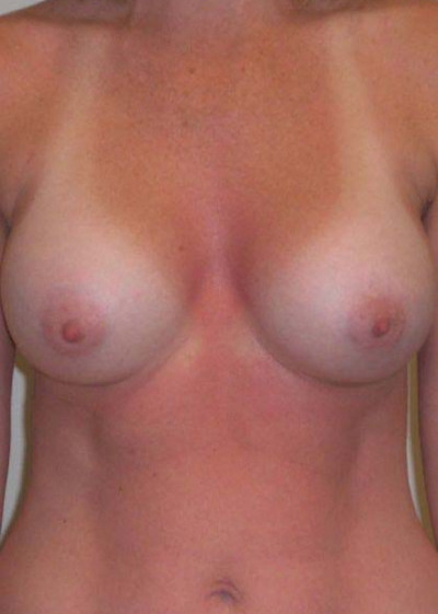 After Image