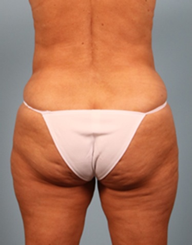After Image