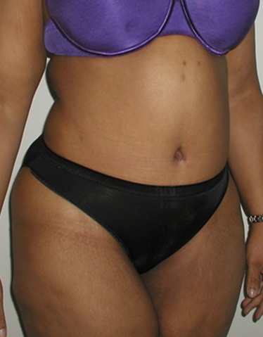After Image