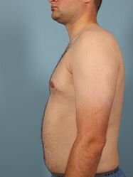 After Image