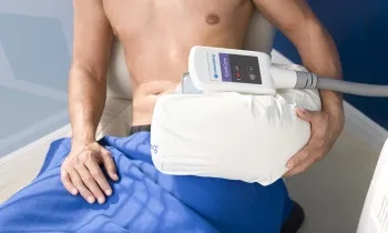 CoolSculpting