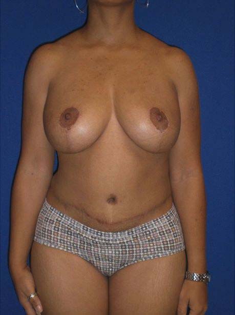 After Image