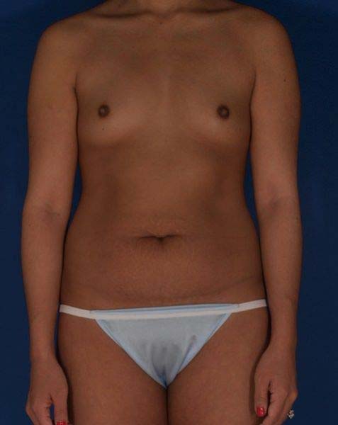 Before Image