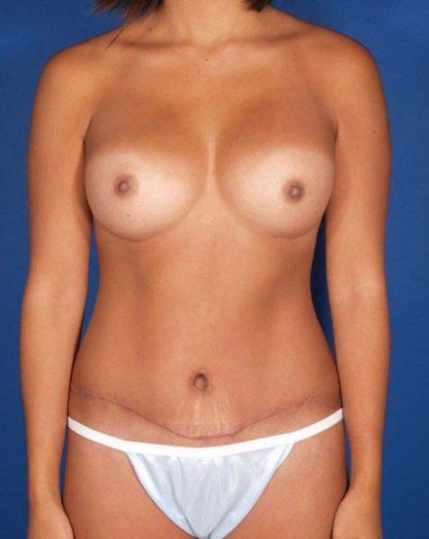 After Image