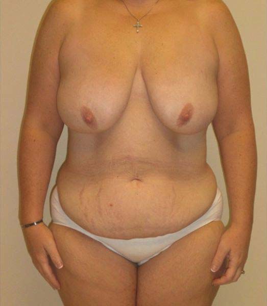 Before Image