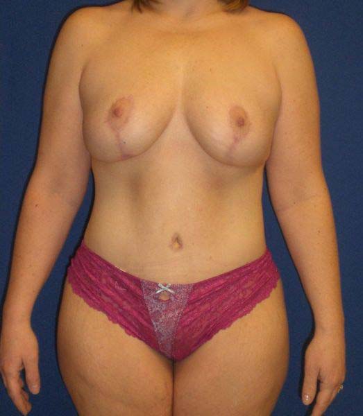 After Image