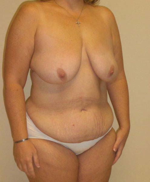 Before Image