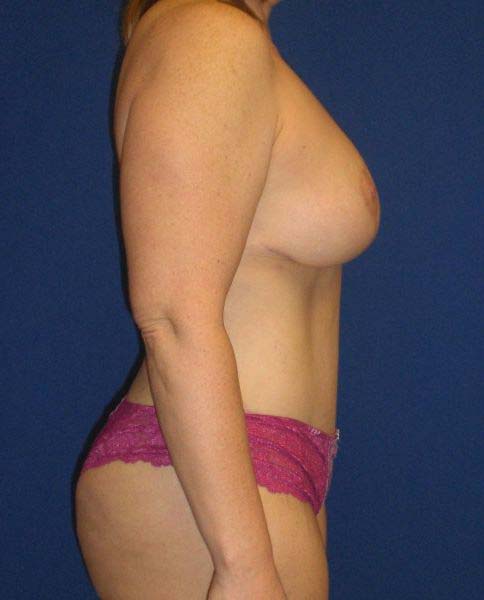 After Image