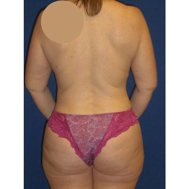 After Image