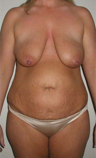 Before Image