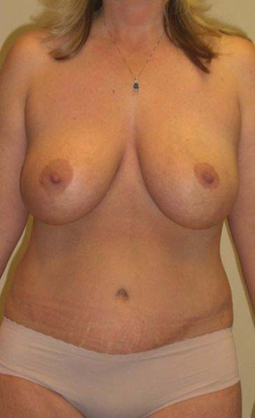After Image