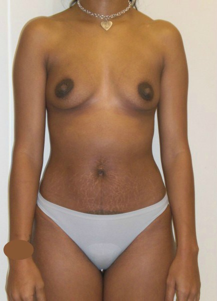 Before Image