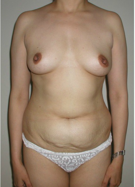 Before Image