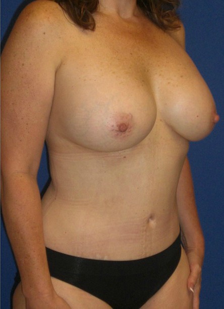After Image