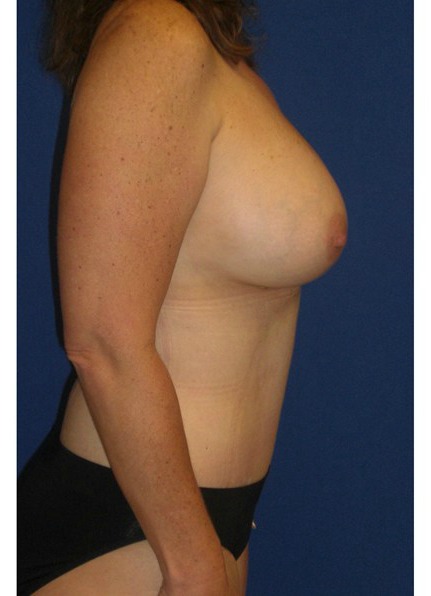 After Image