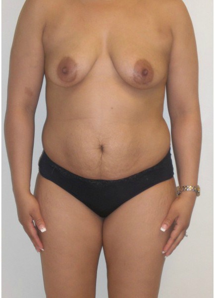 Before Image