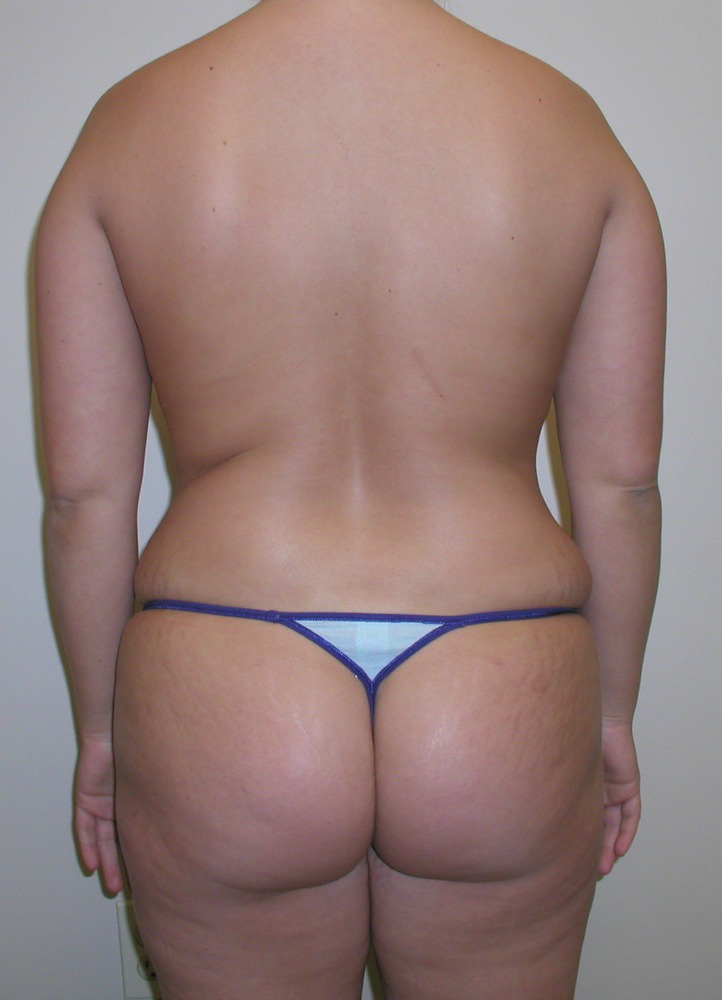 After Image