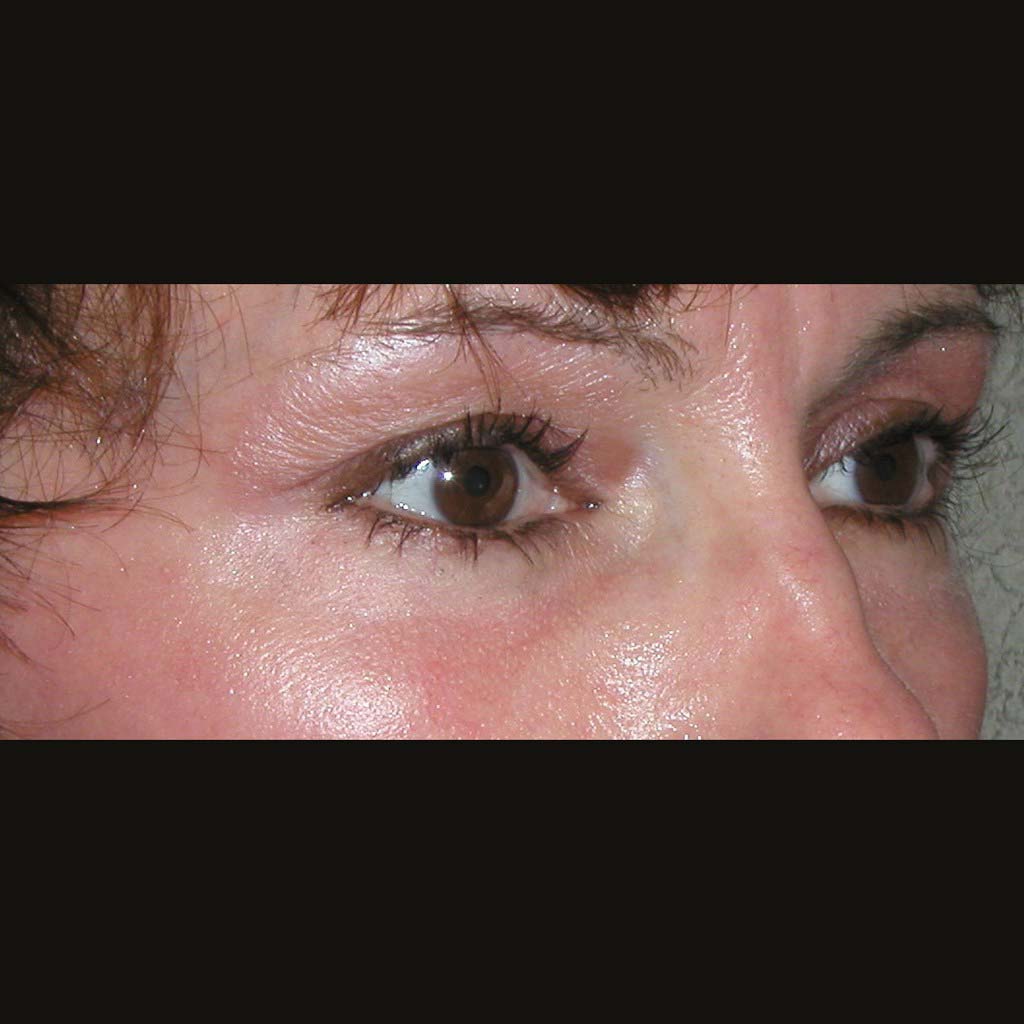 After Image