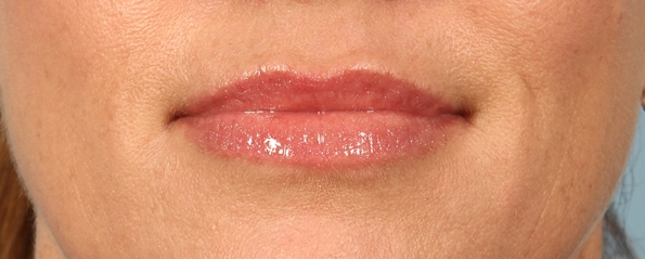 After Image