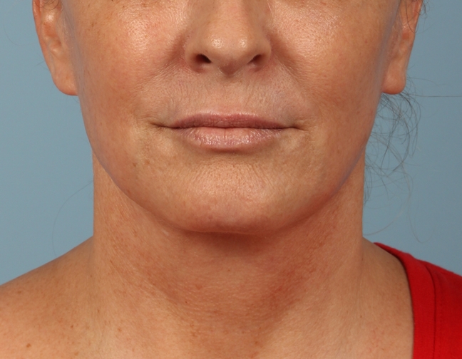 After Image