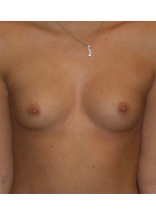 Before Image