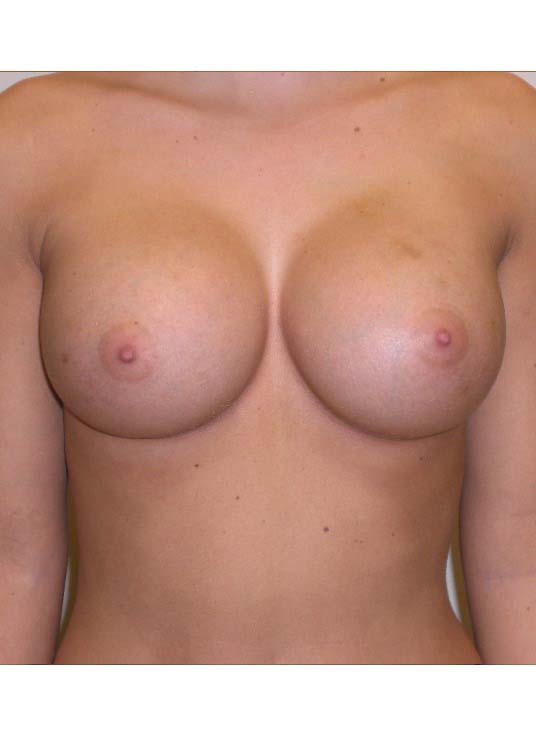 After Image
