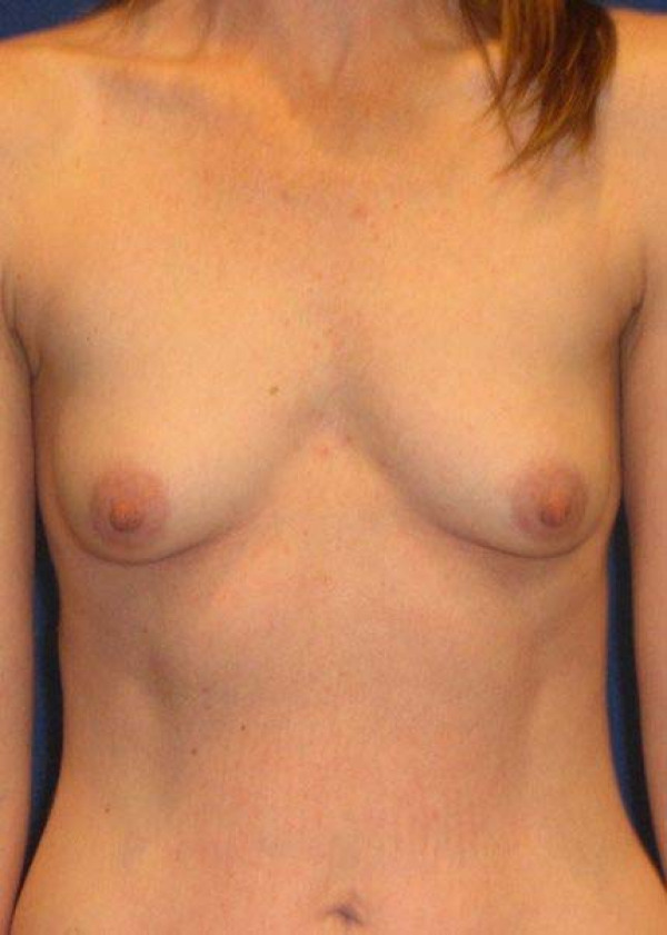 Before Image
