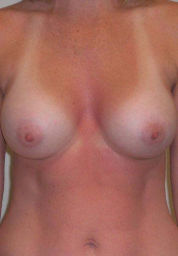 After Image