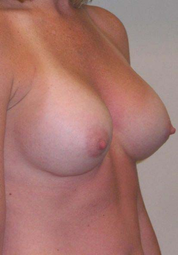 After Image
