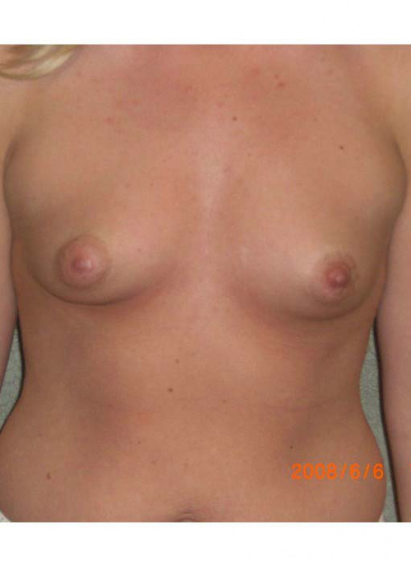 Before Image